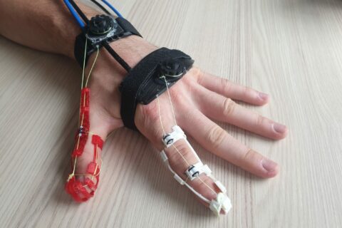 Eine Bandage an einer Hand, die elektrische Aktivität der Haut misst.
